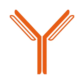 Monoclonal antibodies and cancer a long story up to nanoparticle-mediated targeted drug delivery